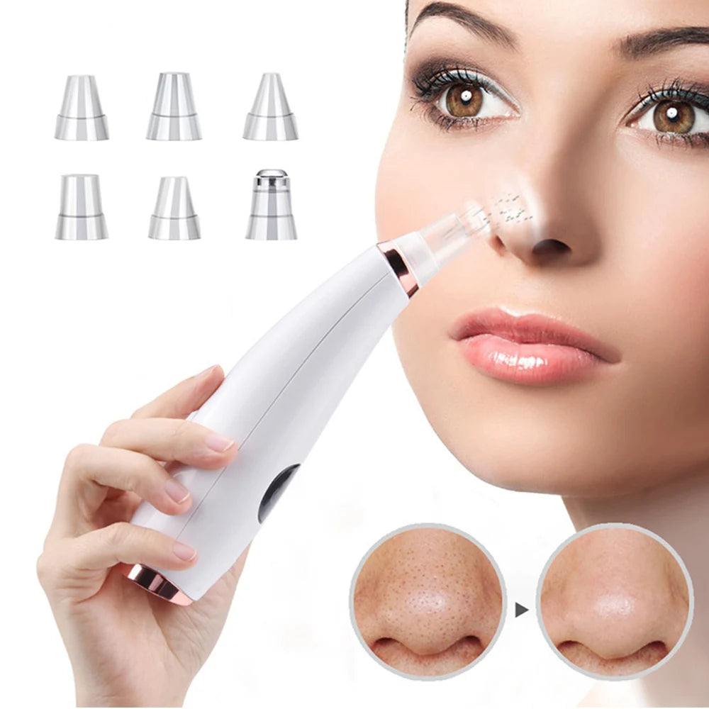 Lisa Blackhead Remover & Vacuum Pore Cleaner