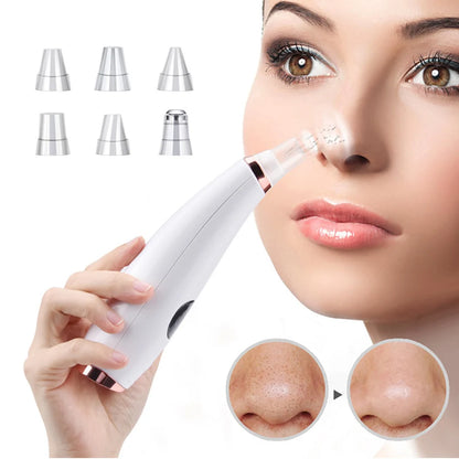 Lisa Blackhead Remover & Vacuum Pore Cleaner