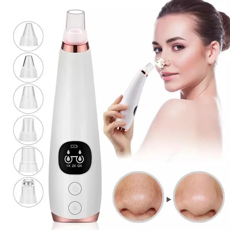 Lisa Blackhead Remover & Vacuum Pore Cleaner