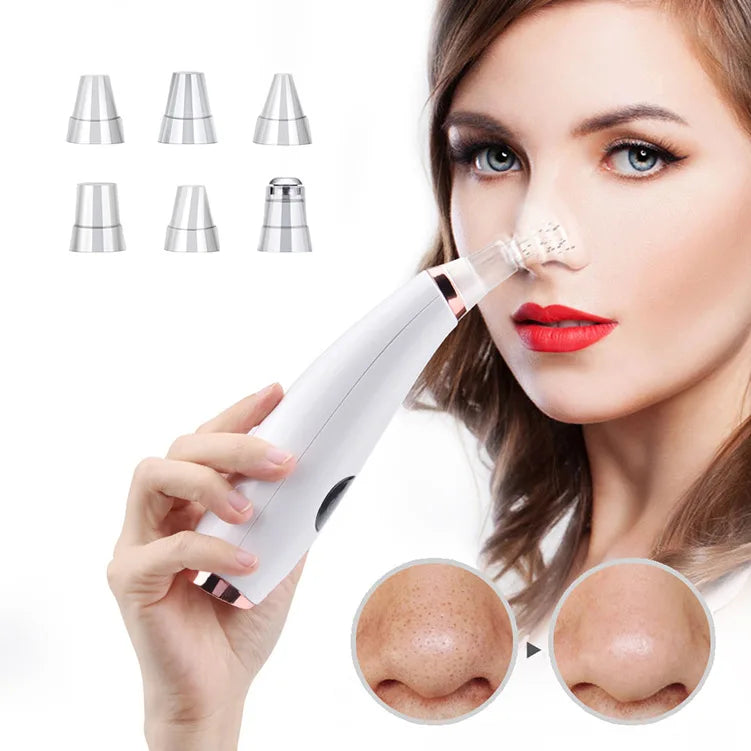 Lisa Blackhead Remover & Vacuum Pore Cleaner