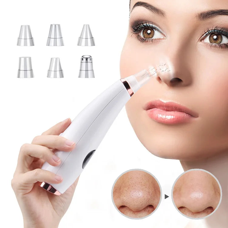 Lisa Blackhead Remover & Vacuum Pore Cleaner